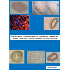 ŠTRUKTURÁLNE ZMENY ŽILOVEJ STENY U PACIENTOV S PRIMÁRNOU FORMOU CHRONICKEJ VÉNOVEJ CHOROBY DOLNÝCH KONČATÍN