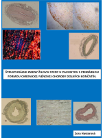 ŠTRUKTURÁLNE ZMENY ŽILOVEJ STENY U PACIENTOV S PRIMÁRNOU FORMOU CHRONICKEJ VÉNOVEJ CHOROBY DOLNÝCH KONČATÍN